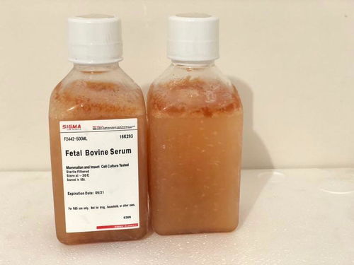 探索血清采購 影響因素與生物制品生產供應商信息管理